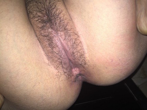 Телки расставили ноги и хвастаются волосатыми пилотками 14 фото